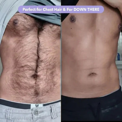 Pain-Free Hair Removal Cream