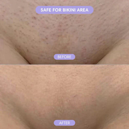Pain-Free Hair Removal Cream